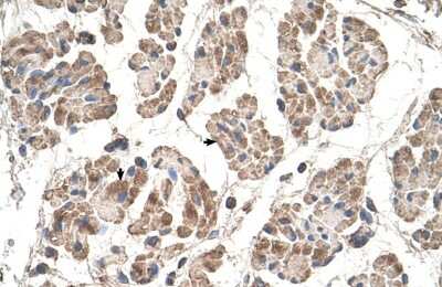 Immunohistochemistry-Paraffin: MOSPD3 Antibody [NBP1-60035]