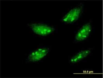 Immunocytochemistry/ Immunofluorescence: MOX1 Antibody (1A10) [H00004222-M01]
