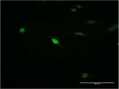 Immunocytochemistry/ Immunofluorescence: MOX1 Antibody (1F3) [H00004222-M23]