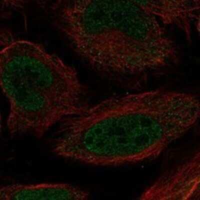 Immunocytochemistry/ Immunofluorescence: MOX1 Antibody [NBP3-17639]