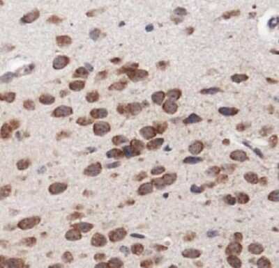 Immunohistochemistry: MP1/MAP2K1IP1 Antibody - BSA Free [NBP1-50631]