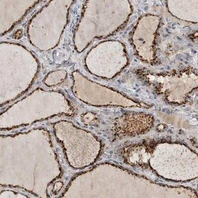 Immunohistochemistry: MP1/MAP2K1IP1 Antibody [NBP1-87837]