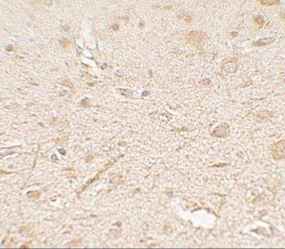 Immunohistochemistry: MP1/MAP2K1IP1 Antibody - BSA Free [NBP2-81886]