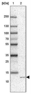 Western Blot: MP1/MAP2K1IP1 Antibody [NBP1-87837]