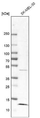 Western Blot: MP1/MAP2K1IP1 Antibody [NBP1-87837]