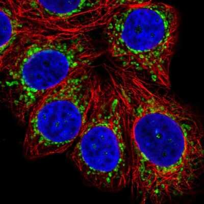 Immunocytochemistry/ Immunofluorescence: MP68 Antibody [NBP2-34119]