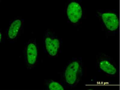 Immunocytochemistry/ Immunofluorescence: MPG Antibody (1E10) [H00004350-M04]