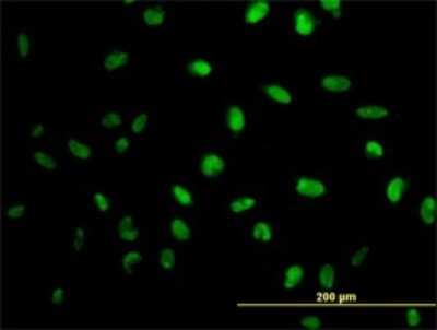 Immunocytochemistry/ Immunofluorescence: MPG Antibody (1G6) [H00004350-M10]