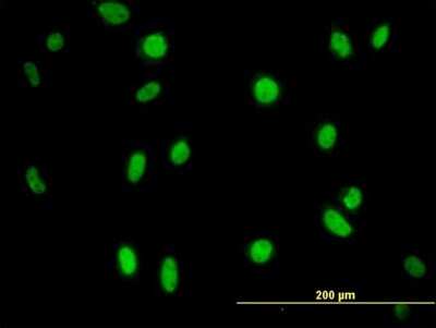 Immunocytochemistry/ Immunofluorescence: MPG Antibody (2C5) [H00004350-M07]