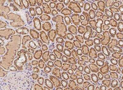 Immunohistochemistry-Paraffin: MPHOSPH1 Antibody [NBP3-05904]