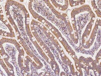 Immunohistochemistry-Paraffin: MPHOSPH1 Antibody [NBP3-05904]