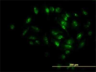Immunocytochemistry/ Immunofluorescence: MPHOSPH10 Antibody (1B10) [H00010199-M02]
