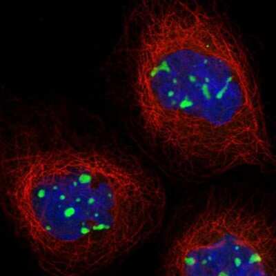 Immunocytochemistry/ Immunofluorescence: MPHOSPH10 Antibody [NBP1-84341]