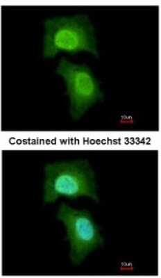 Immunocytochemistry/ Immunofluorescence: MPHOSPH6 Antibody [NBP2-19388]