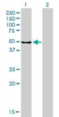Western Blot: MPP1 Antibody (1C3-1D11) [H00004354-M02]