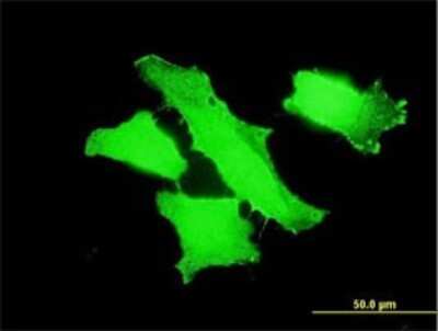 Immunocytochemistry/ Immunofluorescence: MPP1 Antibody (1E11-1G11) [H00004354-M01]