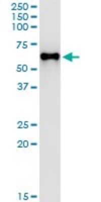 Immunoprecipitation: MPP1 Antibody (1E11-1G11) [H00004354-M01]