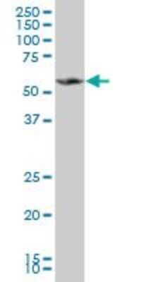 Western Blot: MPP1 Antibody (2E5) [H00004354-M03]
