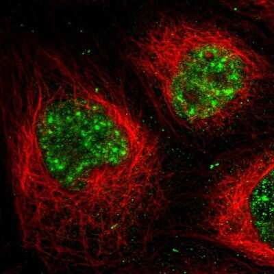 Immunocytochemistry/ Immunofluorescence: MPP1 Antibody [NBP2-55110]