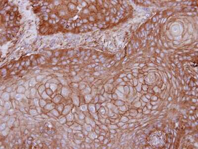 Immunohistochemistry-Paraffin: MPP1 Antibody [NBP1-33051]