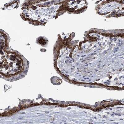 Immunohistochemistry-Paraffin: MPP1 Antibody [NBP3-17059]