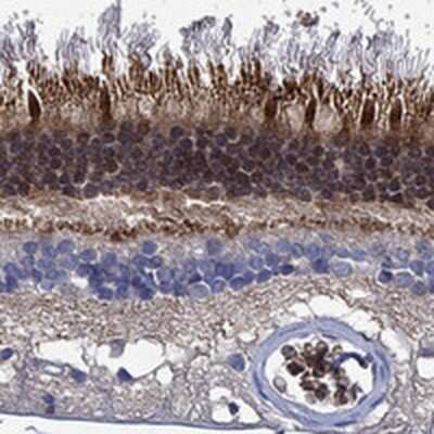 Immunohistochemistry-Paraffin: MPP1 Antibody [NBP3-17059]