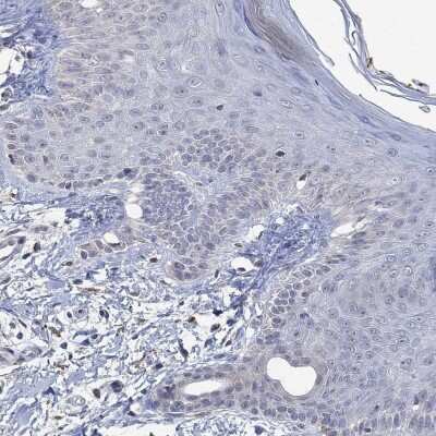 Immunohistochemistry-Paraffin: MPP1 Antibody [NBP3-17059]