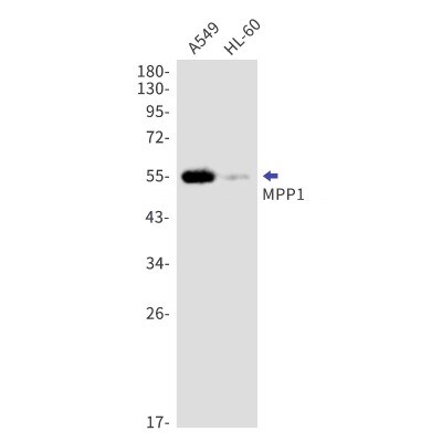 Western Blot: MPP1 Antibody (S03-1F4) [NBP3-19893]