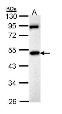Western Blot: MPP1 Antibody [NBP1-33051]