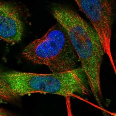 Immunocytochemistry/ Immunofluorescence: MPP3 Antibody [NBP1-85014]