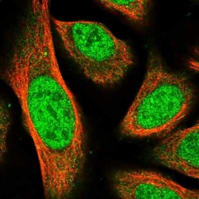 Immunocytochemistry/ Immunofluorescence: MPP3 Antibody [NBP1-85015]