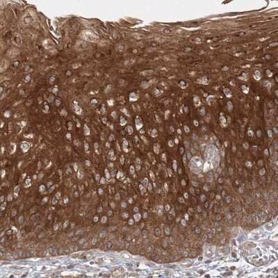 Immunohistochemistry-Paraffin: MPP7 Antibody [NBP1-81989]
