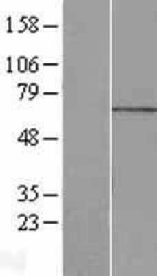 Western Blot: MPP7 Overexpression Lysate [NBL1-13206]
