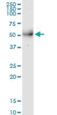 Western Blot: MPPE1 Antibody (3E4) [H00065258-M08]