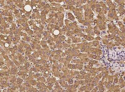 Immunohistochemistry-Paraffin: MPPE1 Antibody [NBP3-05976]