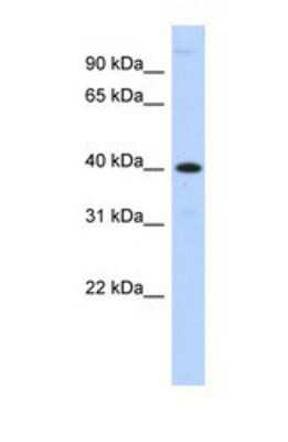 Western Blot: MPPE1 Antibody [NBP1-69305]