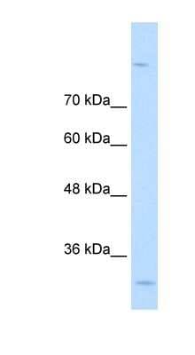 Western Blot: MPPED2 Antibody [NBP1-80499]