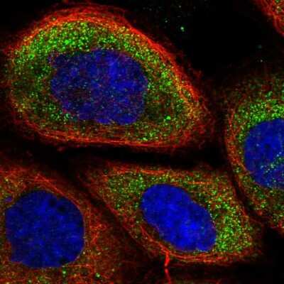Immunocytochemistry/ Immunofluorescence: MPRA Antibody [NBP2-13731]