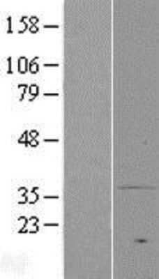 Western Blot: MPRA Overexpression Lysate [NBP2-04977]