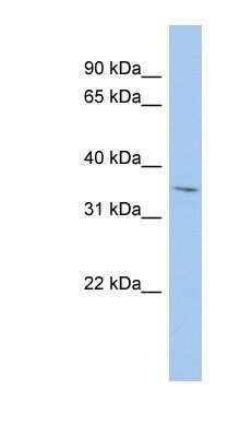 Western Blot: MPST Antibody [NBP1-54734]