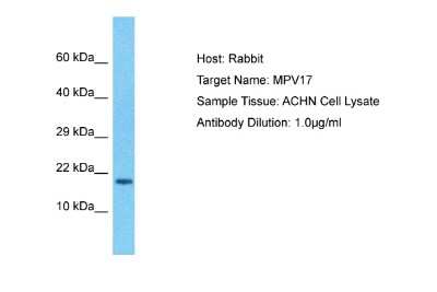 Western Blot: MPV17 Antibody [NBP2-86712]