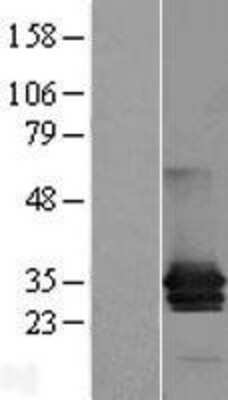 Western Blot: MPZL1 Overexpression Lysate [NBL1-13214]