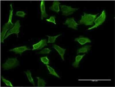 Immunocytochemistry/ Immunofluorescence: MR1 Antibody (5B5) [H00003140-M04]