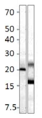 Western Blot: MRAP2 Antibody [NBP3-12227]