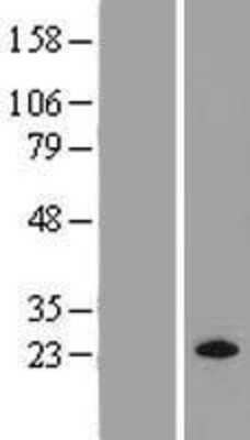 Western Blot: M-Ras/R-Ras3 Overexpression Lysate [NBP2-09288]