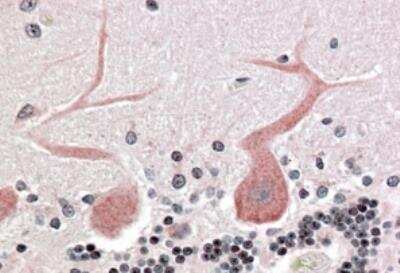 Immunohistochemistry-Paraffin: MRCK Antibody [NB300-829]