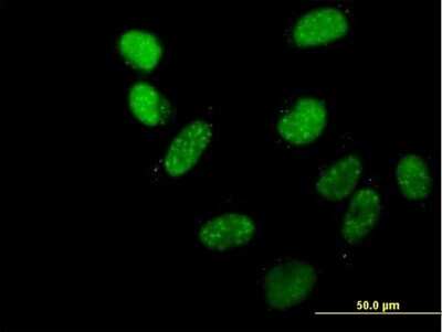 Immunocytochemistry/ Immunofluorescence: MRG-binding protein Antibody [H00055257-B01P]