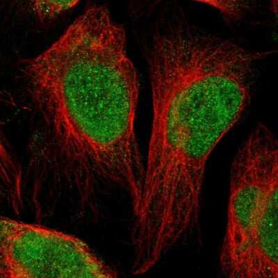 Immunocytochemistry/ Immunofluorescence: MRG-binding protein Antibody [NBP1-84936]
