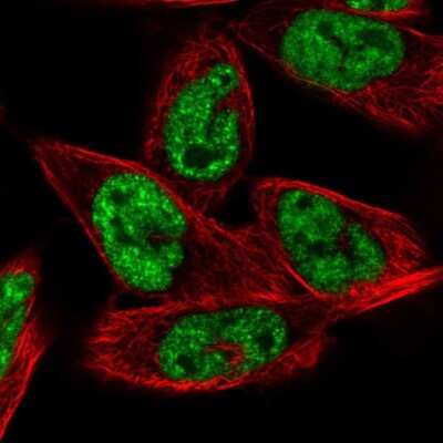 Immunocytochemistry/ Immunofluorescence: MRG15 Antibody [NBP2-56097]