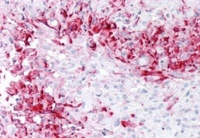 Immunohistochemistry-Paraffin: MRGPRD Antibody [NBP3-14409]
